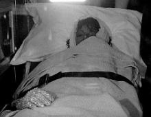 迈克尔·杰克逊在拍广告时遭遇意外烧伤